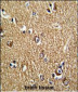 FMR1 Antibody (N-term)