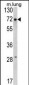 FMR1 Antibody (N-term)