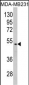 GALT Antibody (C-term)