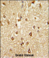 DLX2 Antibody (Center)