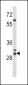 HLA-DRB1 Antibody (N-term)