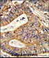 CALR Antibody (Center)
