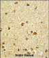 CBFB Antibody (Center)