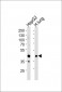 RAGE Antibody (Center)