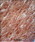 IL2 Antibody (Center)