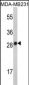 IL2 Antibody (Center)