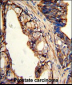 TGM4 Antibody (Center)
