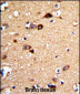 UNC5C Antibody (Center)