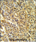 KCNJ2 Antibody (C-term)