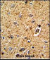 TPH1 Antibody (N-term)