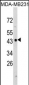 NDRG1 Antibody (N-term)