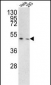 TMPRSS3 Antibody (Center)
