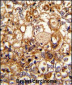 C6 Antibody (N-term)