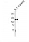 C6 Antibody (N-term)