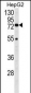 HEXA Antibody (N-term)