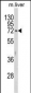 HEXA Antibody (N-term)