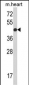 RGP1 Antibody (C-term)