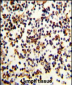 CR2 Antibody (C-term)