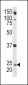 Rab5 Antibody (C-term)