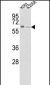 FPGS Antibody (Center)