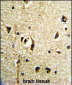 FTO Antibody (N-term)