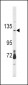 CLEC16A Antibody (Center)