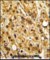 ITGAX Antibody (C-term)