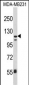 ITGAX Antibody (C-term)