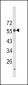 LAG3 Antibody (Center)