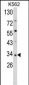 SFRP5 Antibody (Center)