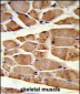 RANBP9 Antibody (Center)