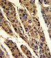 TPT1 Antibody (Center)