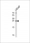 TPT1 Antibody (Center)