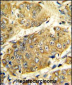 LTA Antibody (Center)