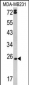 LTA Antibody (Center)