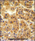 SIL1 Antibody (Center)