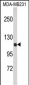 ACTN1 Antibody (N-term)