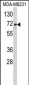 ARHGAP18 Antibody (Center)