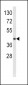 HLA-E Antibody (Center)