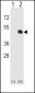 HLA-E Antibody (Center)