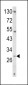 TRAP Antibody (C-term)