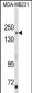 TBC1D4 Antibody (N-term)