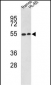 NR1H2 Antibody (N-term)