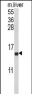 CCL3 Antibody (C-term)