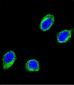 AP8528c-CCHCR1-Antibody-Center