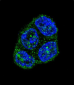 FAS Antibody (Center)