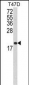 FAS Antibody (Center)