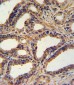 NPPA Antibody (N-term)