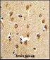 ABI1 Antibody (N-term)