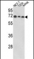 ABI1 Antibody (N-term)